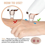 5 in 1 Multifunction Blackhead Removal Rechargeable Machine
