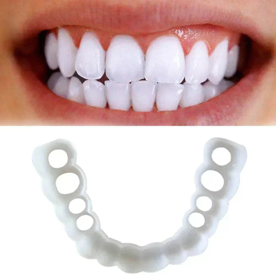 Snap on smile
