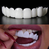 Snap on smile